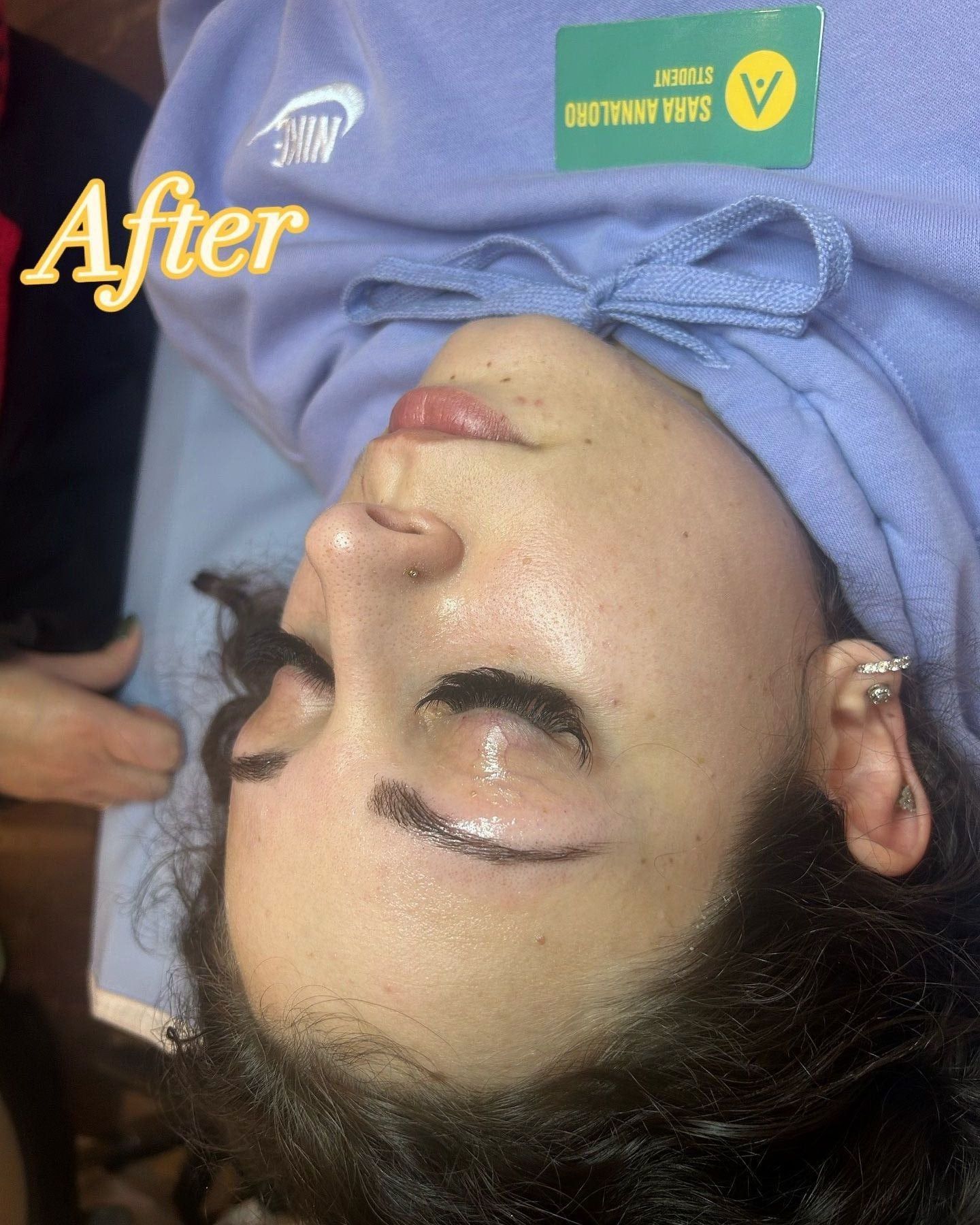 Before and after example - after