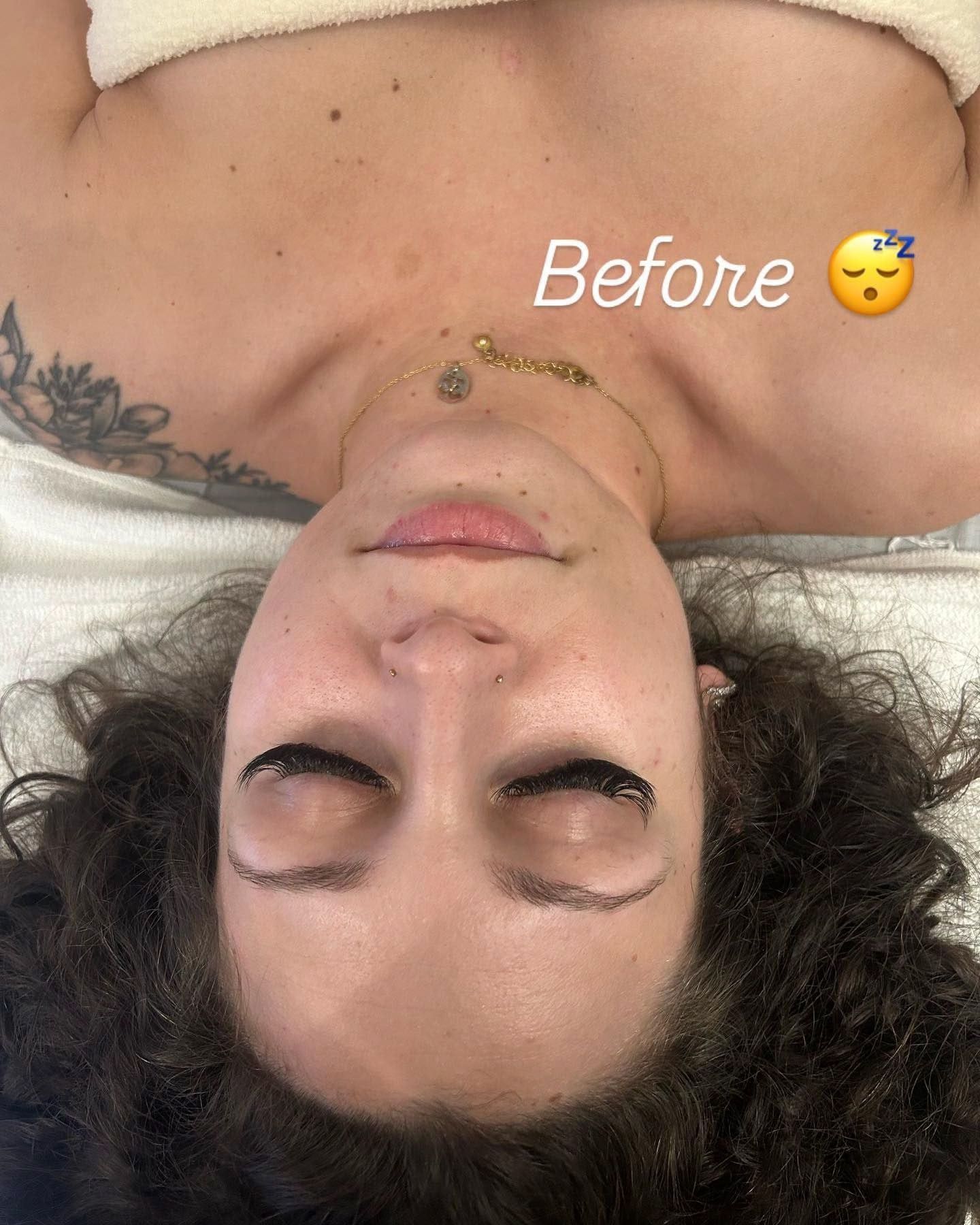 Before and after example - before